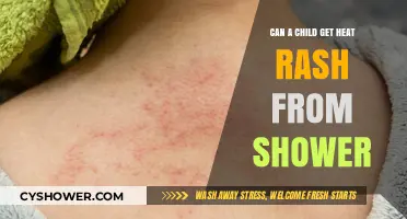 Can Showering Cause Heat Rash in Children? Expert Insights Revealed