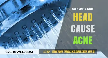 Dirty Shower Heads and Acne: Uncovering the Hidden Skin Connection