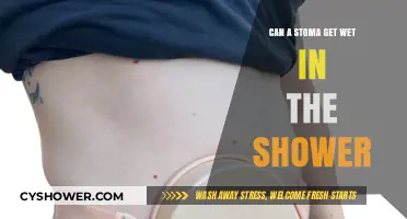 Showering with a Stoma: Can It Safely Get Wet?