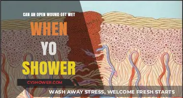 Showering with an Open Wound: Can It Safely Get Wet?
