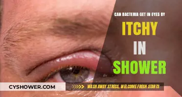 Can Shower Itching Introduce Bacteria to Your Eyes? Find Out
