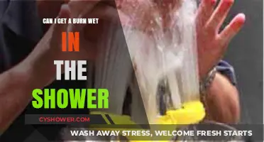 Can You Safely Wet a Burn in the Shower? Expert Advice