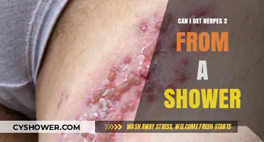 Can You Contract Herpes 2 from Sharing a Shower?