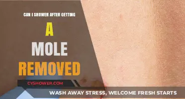 Showering After Mole Removal: Safe Practices and Healing Tips