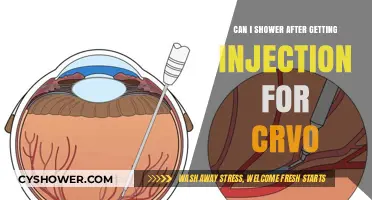 Showering After CRVO Injection: Safety Tips and Precautions