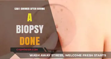 Showering After a Biopsy: What You Need to Know