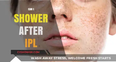 Post-IPL Shower Guide: When and How to Safely Cleanse Skin