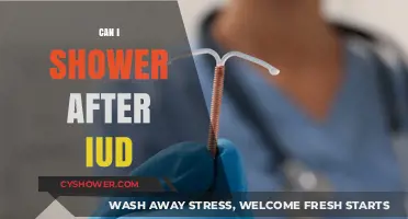 Showering After IUD Insertion: What You Need to Know
