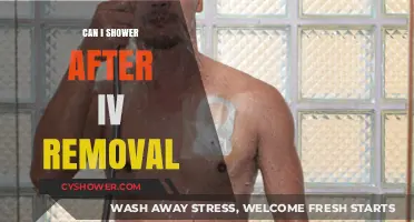 Showering After IV Removal: Safe Practices and Tips for Healing