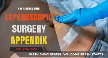 Showering Safely After Laparoscopic Appendectomy: Tips for a Smooth Recovery