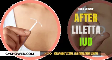 Showering After Liletta IUD: Safe Practices and Post-Insertion Care Tips