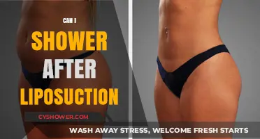 Showering After Liposuction: Timing, Safety, and Post-Op Care Tips