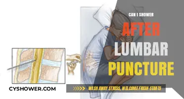 Showering After Lumbar Puncture: Safety Tips and Recovery Guidelines