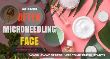 Microneedling Aftercare: When Can You Shower Post-Treatment?