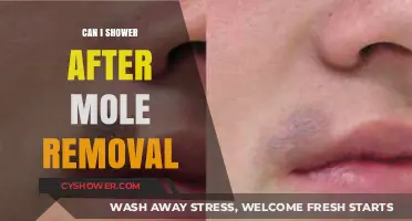 Showering After Mole Removal: What You Need to Know