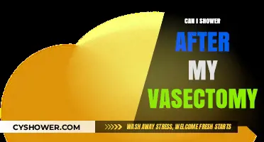 Showering After a Vasectomy: What You Need to Know