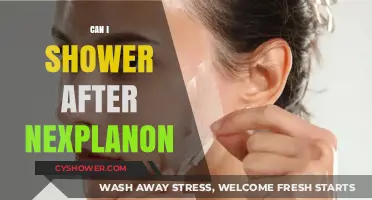 Showering After Nexplanon: What You Need to Know