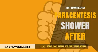 Showering After Paracentesis: Safety Tips and Post-Procedure Care Guide