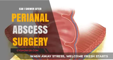 Post-Perianal Abscess Surgery: When Can You Safely Shower Again?