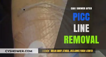 Showering Safely After PICC Line Removal: What You Need to Know