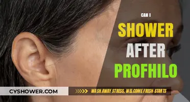 Profhilo Aftercare: Showering Safely Post-Treatment – What You Need to Know