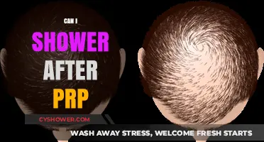 Showering After PRP Treatment: What You Need to Know