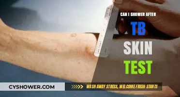 Showering After TB Skin Test: What You Need to Know