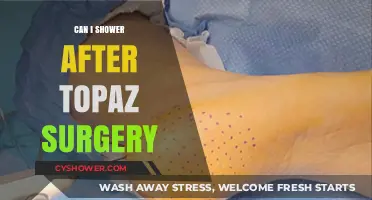 Showering After Topaz Surgery: What You Need to Know