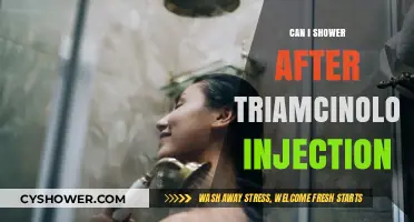 Showering Post-Triamcinolone Injection: Safe Practices and Precautions