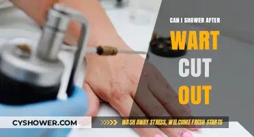 Showering After Wart Removal: What You Need to Know