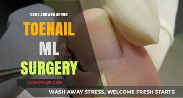 Showering After Toenail Surgery: What You Need to Know