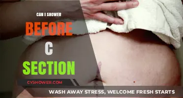 Showering Before a C-Section: What You Need to Know