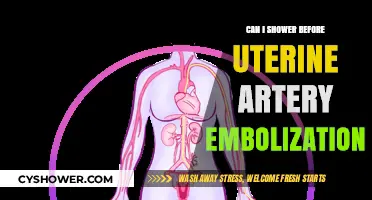 Showering Before Uterine Artery Embolization: What You Need to Know