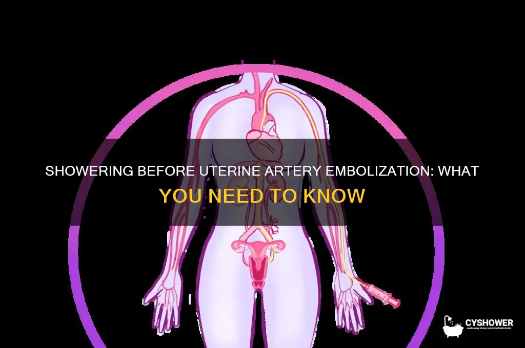 can i shower before uterine artery embolization