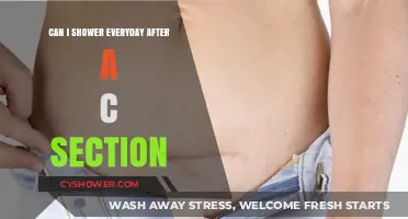 Post-C-Section Shower Guide: Daily Showers Safe or Not?