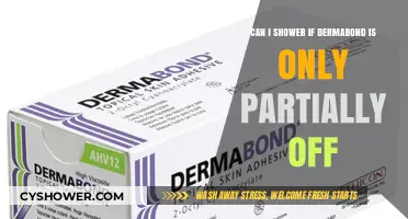 Showering with Partially Removed Dermabond: Safe or Risky?