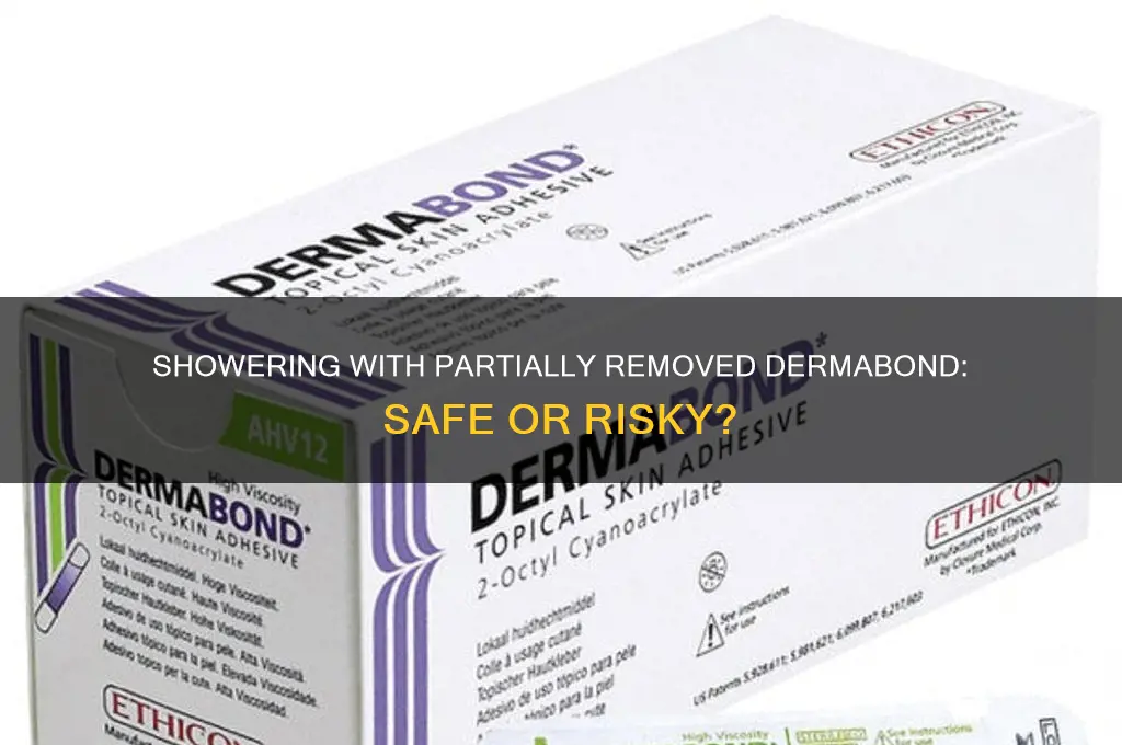 can i shower if dermabond is only partially off