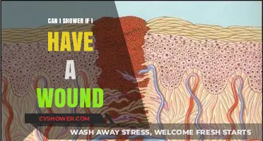 Showering with a Wound: Safe Practices and Healing Tips