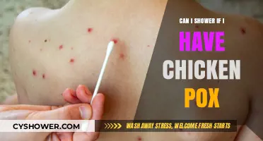 Showering with Chicken Pox: Safe Practices and Precautions to Follow