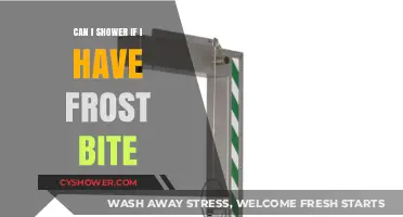 Showering with Frostbite: Safe Practices and What You Need to Know