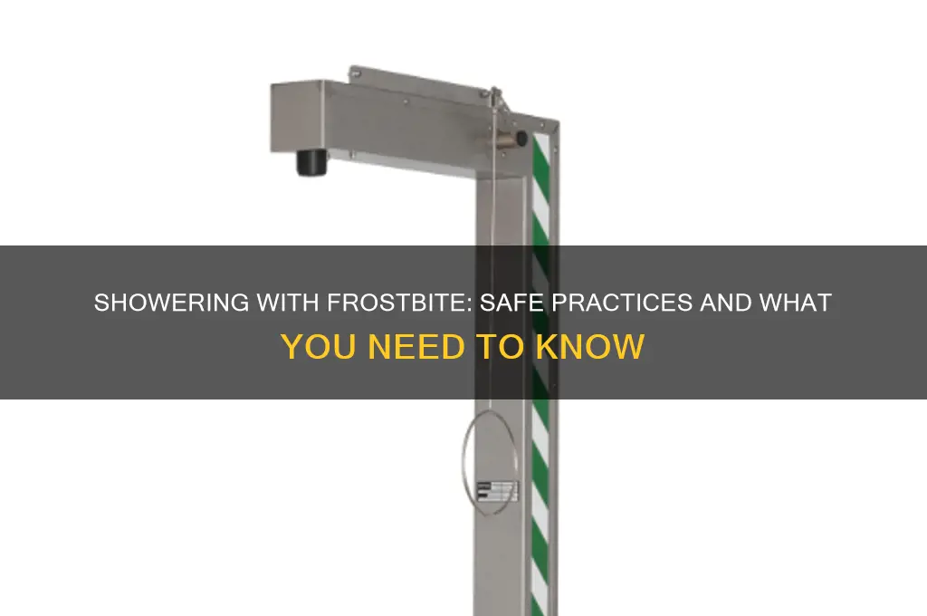 can i shower if i have frost bite