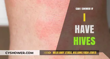Showering with Hives: Safe Practices and Tips for Relief