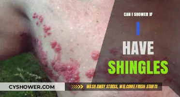 Showering with Shingles: Safe Practices and Precautions to Consider