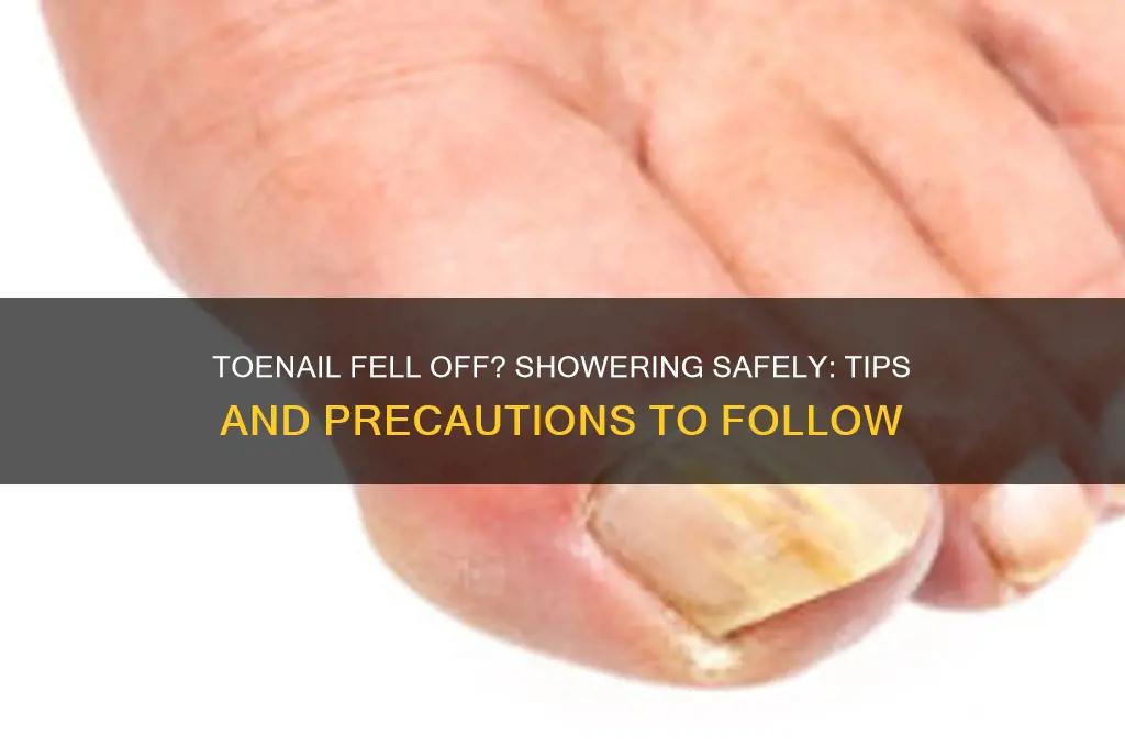 can i shower if my toenail fell off