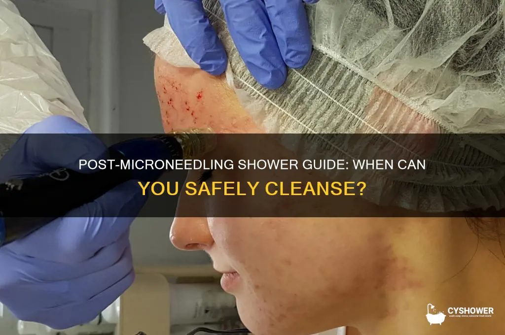 can i shower the day after microneedling