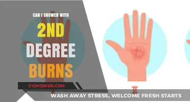 Showering Safely: What to Know About 2nd Degree Burns