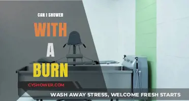 Showering with a Burn: Safe Practices and Healing Tips