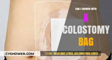 Showering with a Colostomy Bag: Tips for Comfort and Confidence