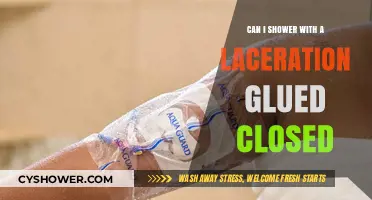 Showering with a Glued Laceration: Safe Practices and Precautions