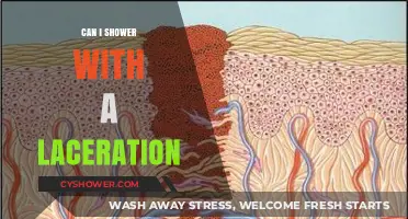 Showering with a Laceration: Safe Practices and Healing Tips